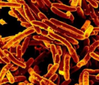 科学家发现了使引起结核病的细菌饥饿的潜在方法