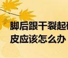 脚后跟干裂起硬皮怎么办?（脚后跟干裂起硬皮应该怎么办）