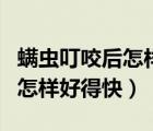 螨虫叮咬后怎样彻底消除小妙招（螨虫叮咬后怎样好得快）