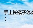 手上长瘊子怎么治用什么药膏（治瘊子的药膏）