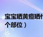 宝宝晒黄疸晒什么部位（宝宝晒黄疸主要晒哪个部位）
