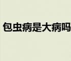 包虫病是大病吗（医学上包虫病是什么意思）