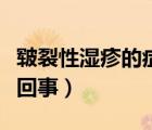 皲裂性湿疹的症状有哪些（皲裂性湿疹是怎么回事）