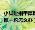 小脚趾指甲厚厚一坨是哪的人（小脚趾指甲厚厚一坨怎么办）