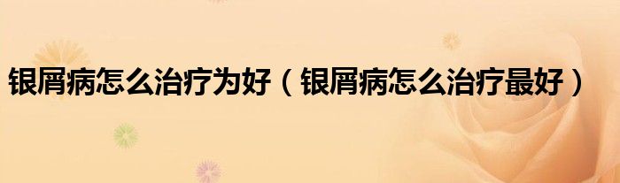 银屑病怎么治疗为好（银屑病怎么治疗最好）