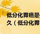 低分化胃癌是什么意思,得了这个癌最长活多久（低分化胃癌）