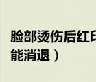 脸部烫伤后红印多久能消退（烫伤后红印多久能消退）