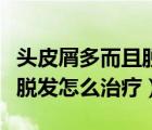 头皮屑多而且脱发怎么治疗呢（头皮屑多而且脱发怎么治疗）