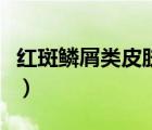 红斑鳞屑类皮肤病（什么是红斑鳞屑性皮肤病）