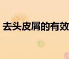 去头皮屑的有效方法（去头皮屑最好的方法）