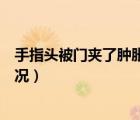 手指头被门夹了肿胀疼痛怎么办（手指头肿胀疼痛是什么情况）