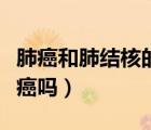 肺癌和肺结核的症状区别（肺结核会误诊为肺癌吗）