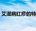 艾滋病红疹的特点图片（艾滋病红疹的特点）