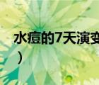 水痘的7天演变过程图片（水痘破了怎么处理）