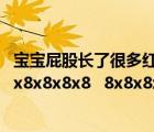 宝宝屁股长了很多红点点怎么办（8 8x8 8x8x8 8x8x8x8 8x8x8x8x8   8x8x8x8x8x8x8x8x8x8x8x8x）
