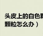 头皮上的白色颗粒是什么（头皮上有白色的小颗粒怎么办）