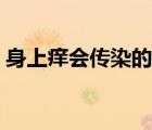 身上痒会传染的是什么病（梅毒身上会痒吗）
