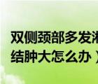 双侧颈部多发淋巴结肿大（双侧颈部多发淋巴结肿大怎么办）