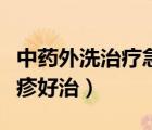 中药外洗治疗急性荨麻疹道客巴巴（急性荨麻疹好治）