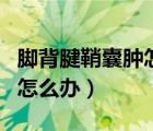 脚背腱鞘囊肿怎么办才能消除（脚背腱鞘囊肿怎么办）