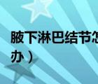 腋下淋巴结节怎么消除（腋下淋巴结肿大怎么办）
