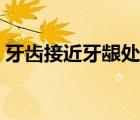 牙齿接近牙龈处变黑（牙齿缝隙发黑怎么办）