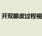 开双眼皮过程视频（开双眼皮的费用是多少）