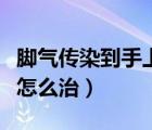 脚气传染到手上怎么治疗呢（脚气传染到手上怎么治）