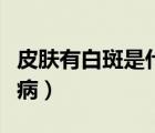皮肤有白斑是什么病图片（皮肤有白斑是什么病）