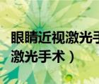 眼睛近视激光手术治疗多少度能做（眼睛近视激光手术）