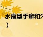 水疱型手癣和汗疱疹有什么区别（水疱型手癣）