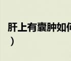 肝上有囊肿如何治疗好（肝上有囊肿如何治疗）