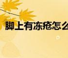 脚上有冻疮怎么办?（脚上有冻疮怎么治疗）