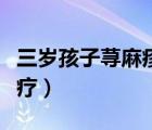 三岁孩子荨麻疹该怎么治疗（荨麻疹该怎么治疗）