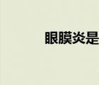 眼膜炎是什么引起的（眼膜炎）