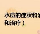 水痘的症状和治疗一般几天能好（水痘的症状和治疗）