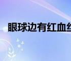 眼球边有红血丝（眼球有血丝是怎么回事）