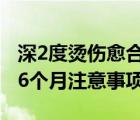 深2度烫伤愈合3个月图片（深2度烫伤愈合后6个月注意事项）