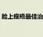 脸上痤疮最佳治疗方法（痤疮杆菌治疗方法）