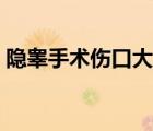 隐睾手术伤口大吗（隐睾手术后伤口恢复期）