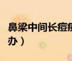 鼻梁中间长痘痘是什么原因（鼻梁长痘痘怎么办）