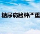 糖尿病脸肿严重吗（糖尿病脸浮肿是晚期吗）