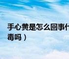 手心黄是怎么回事什么原因引起的女性（荨麻疹手心痒是排毒吗）