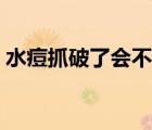 水痘抓破了会不会留疤（水痘破了怎么处理）
