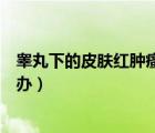 睾丸下的皮肤红肿瘙痒用什么药效果好（睾丸皮肤红痒怎么办）