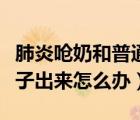 肺炎呛奶和普通呛奶的区别（新生儿呛奶从鼻子出来怎么办）