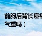 前胸后背长痘痘是湿气重吗（后背长痘痘是湿气重吗）