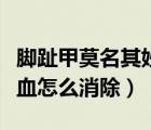 脚趾甲莫名其妙黑了一块不疼（指甲里面有淤血怎么消除）