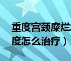 重度宫颈糜烂怎么引起的（19岁宫颈糜烂重度怎么治疗）