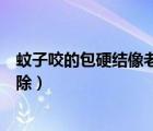 蚊子咬的包硬结像老茧还痒（蚊子咬的包一直有硬结怎么消除）